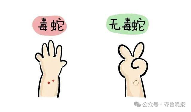 安徽宣城一男子走路玩手机<strong></p>
<p>美股pg</strong>，一脚踩中打架的竹叶青和五步蛇，被俩毒蛇咬3口！医院：暂无生命危险，正在治疗